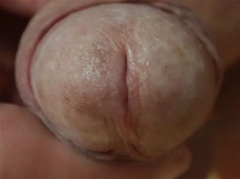 Close Up Penis 13 Nude Pics XHamster