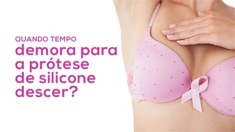 Quanto tempo demora para a prótese de silicone baixar Silicone Center