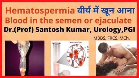 Blood In Semen Blood After Sex Hematospermia Dr