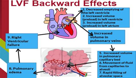 Heart Failure Diagram