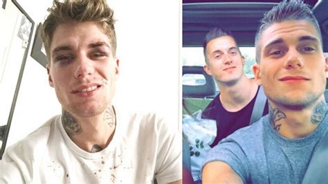 Casal gay é espancado e viraliza nas redes ao mandar mensagem para