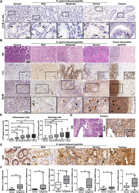 lymphotoxin  receptor ltvr signalling  activated  helicobacter