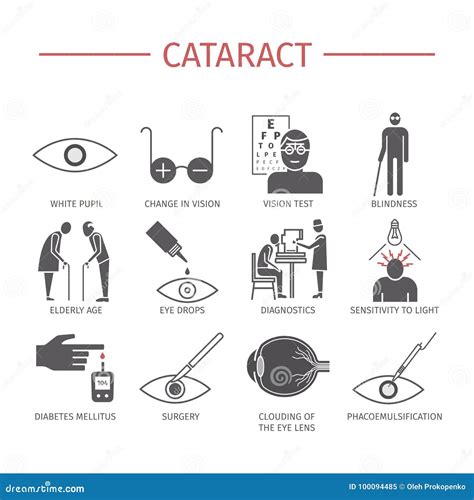 Cataract Symptomen Behandeling Geplaatste Pictogrammen Vectortekens