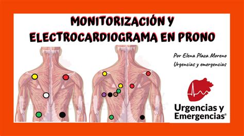 Electrocardiografía Urgencias Y Emergencias®