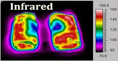 Infrared Radiation