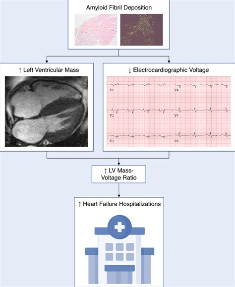 Indexed LV Massvoltage Ratio Reflects Amyloid Burden And Is Associated