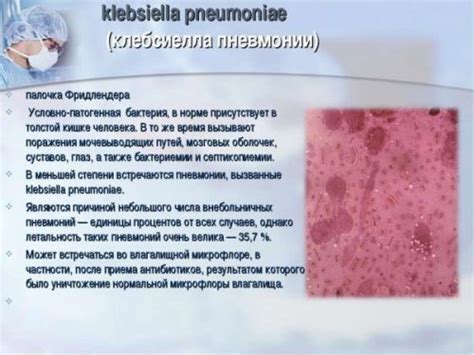 Клебсиелла (klebsiella pneumoniae) - бактерия при пневмонии: лечение ...