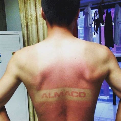 20 Hilarious Tan Lines That'll Make You Never Want To Step Outside Again