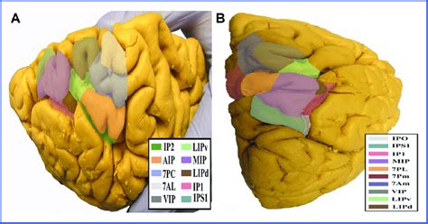 Anatomic View Of The Superior Parietal Lobule Parcellations Shown On