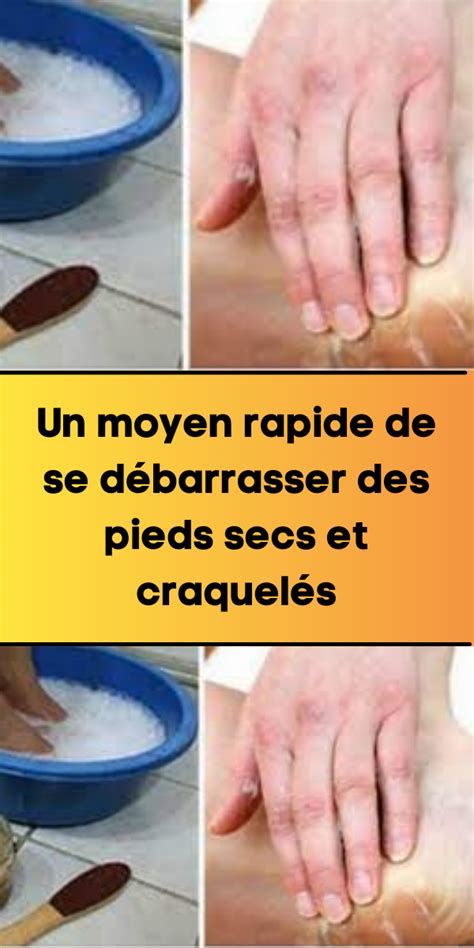 Un Moyen Rapide De Se D Barrasser Des Pieds Secs Et Craquel S Artofit