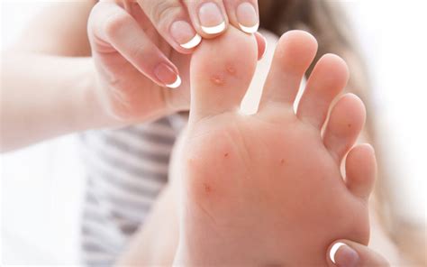 how to fix crooked toenails