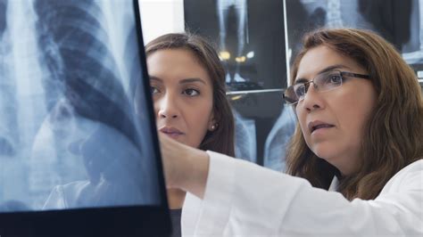 McKesson Change Healthcare buying PokitDok, blockchain health tech