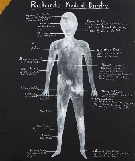 Richard Lewer: Richard’s medical disasters :: Sir John Sulman Prize
