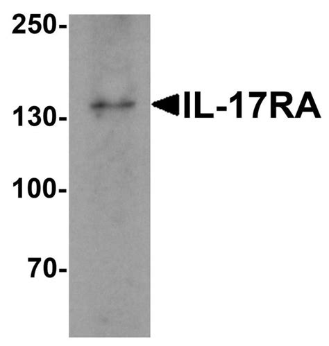 Anti Il Ra Antibody Rabbit Anti Human Polyclonal Elisa If Ihc Wb Lsbio