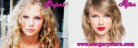 Taylor Swift Plastic Surgery Before and After Pictures