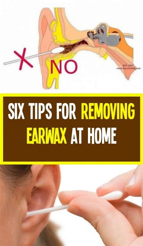 Ear Wax Removal Thing