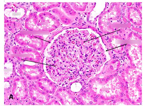 Histology of Nephron Diagram | Quizlet