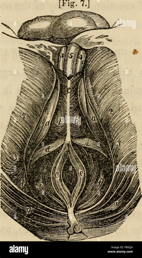 This work discusses the causes of sterility in both males and females ...