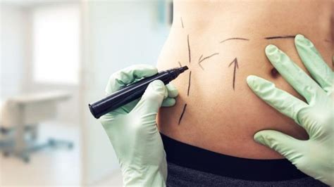 Tout savoir sur le lipolaser du ventre différence avec la liposuccion