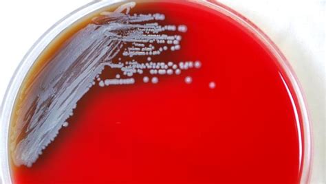 Deadly Tropical Bacteria Found In Mainland US Soil For First Time ...