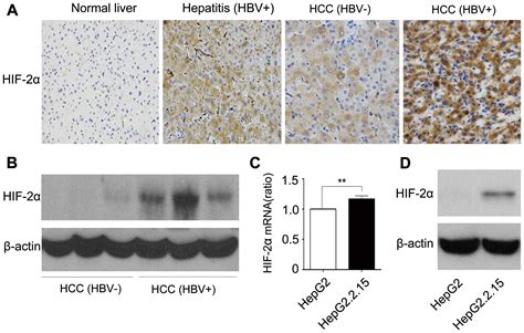 Hepatitis B virus induces hypoxia inducible factor 2α expression