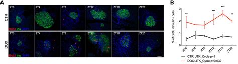 The core clock transcription factor BMAL1 drives circadian β cell