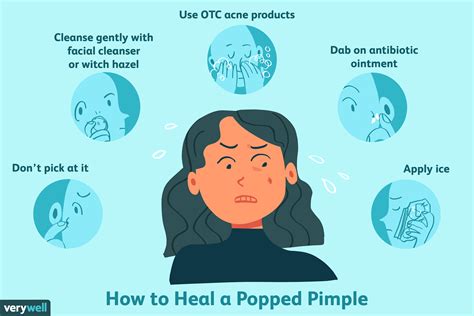 How to Heal a Popped Pimple Scab