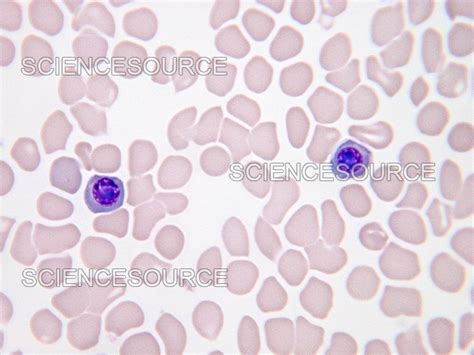 Nucleated Red Blood Cells