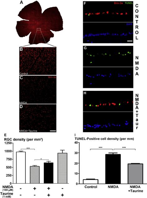 Taurine Induced Prevention Of The Nmda Induced Apoptosis And Loss Of