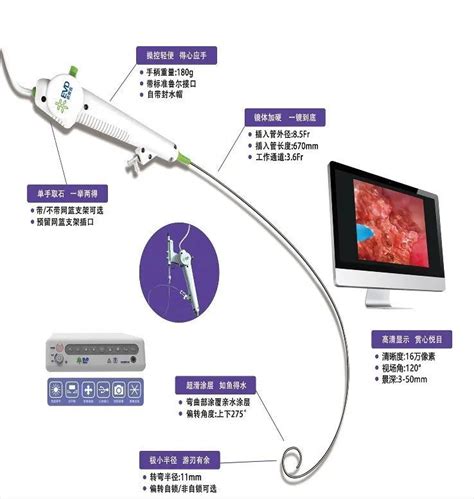 获证一次性使用电子输尿管肾盂内窥镜导管 腾讯新闻