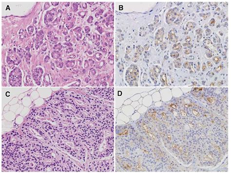 Figure From Somatostatin Analogue Inhibits The Mobility Of Prostate