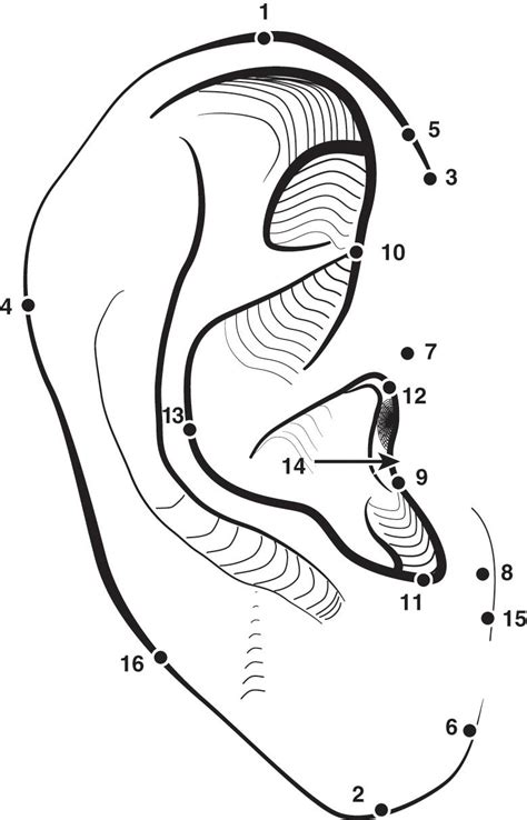 Microtia And Otoplasty Clinical Tree