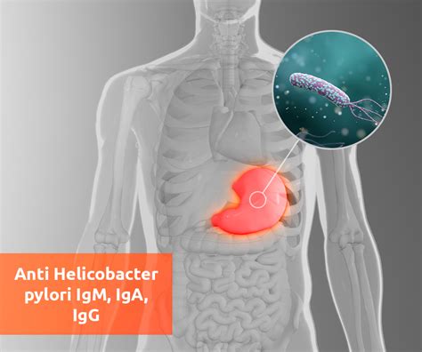 Anti Helicobacter Pylori Igm Iga Igg Lab Online