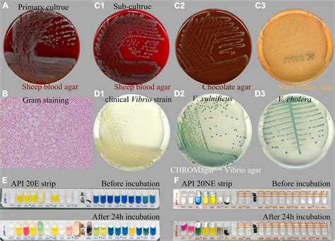 Frontiers Characteristic And Otopathogenic Analysis Of A Vibrio Alginolyticus Strain