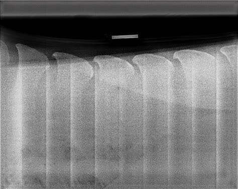radiography   equine spine imv imaging