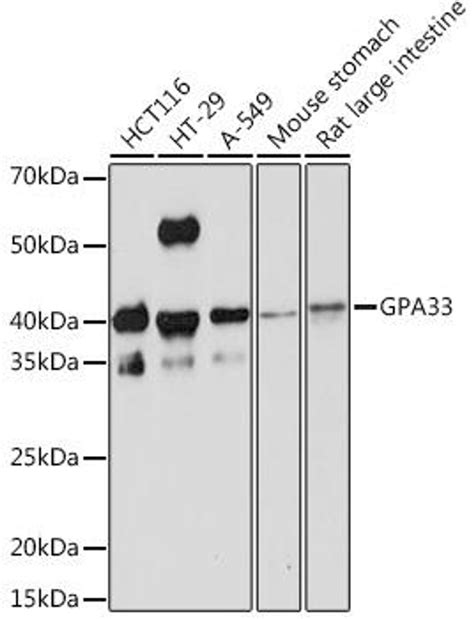 Anti Gpa33 抗体 Assay Genie