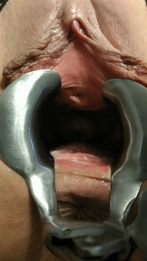 Speculum Sounding And Urethra Jewelry 29 Nude Pics XHamster