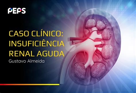 Caso Cl Nico Insufici Ncia Renal Aguda Peps