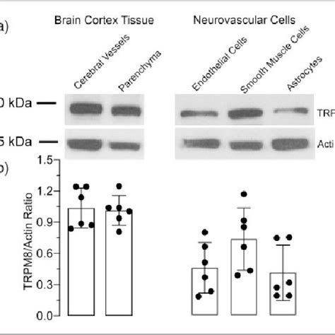 Trpm Expression In The Brain Cortex Tissue And In Cerebral Vascular