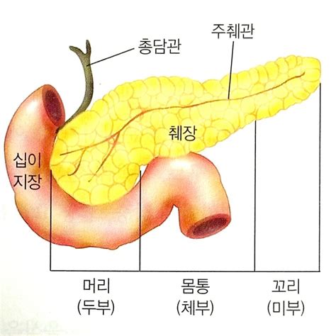 췌장질환 급성췌장염과 만성췌장염