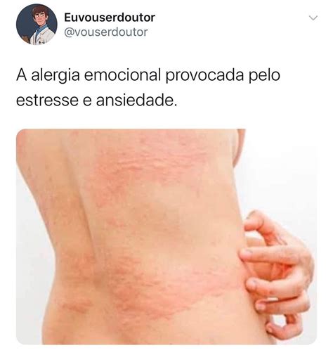 Pin Em Alergias