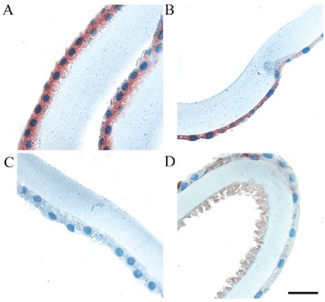 Immunohistochemical staining of MGST1 in (A, B) control patients ...