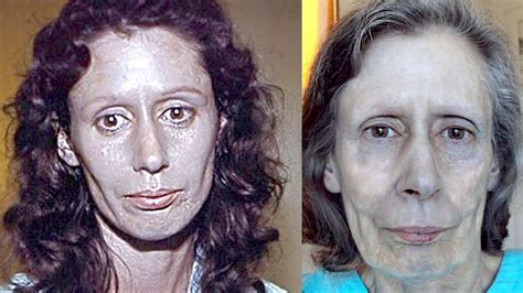 Woman's Skin Turns Silver For 60 Years - Rosemary Jacobs - YouTube