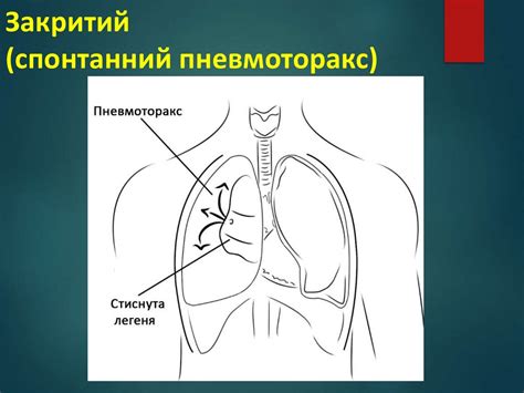 3.1Травми м'яких тканин - презентация онлайн