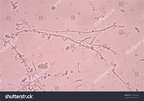Budding Yeast Cell Structure Stock Photo 343429295 | Shutterstock