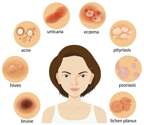 Top 27 Background Images Types Of Skin Problems On Face With Pictures