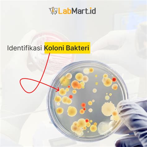 Jenis Jenis Media Mikrobiologi Dan Fungsinya Labmart Id