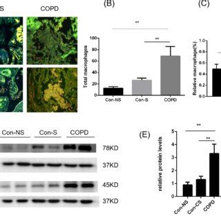 MicroRNA let-7 inhibits M2 macrophage polarization through the ...