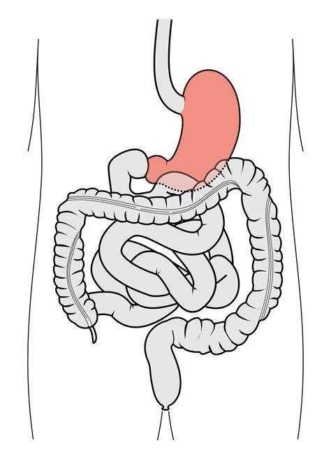 Ep 28 Why Does My Stomach Growl Your Nutrition Profs