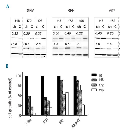 Knockdown of PLK1 leads to growth reduction and apoptosis in ALL cell ... 